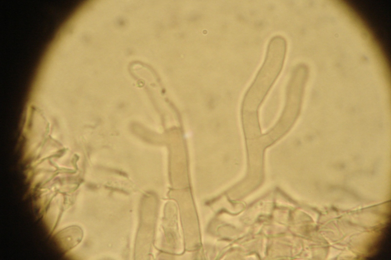 da determinare (Phanerochaete sordida)